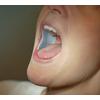 DryDent Parotid